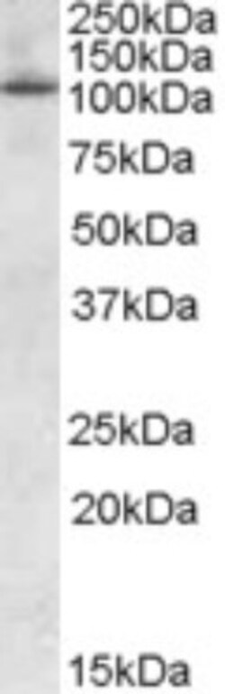 OSBPL5 Antibody, Novus Biologicals 0.1mg; Unlabeled:Antibodies, Polyclonal